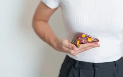 Diet, Weight Loss and Gallstones: Practical Advice for Patients